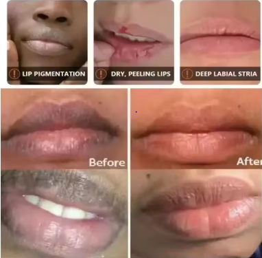 Rapidly brightening lip mask, darkening lip balm, exfoliating serum, reducing lip lines, repairing and caring for lips