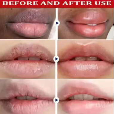 Rapidly brightening lip mask, darkening lip balm, exfoliating serum, reducing lip lines, repairing and caring for lips