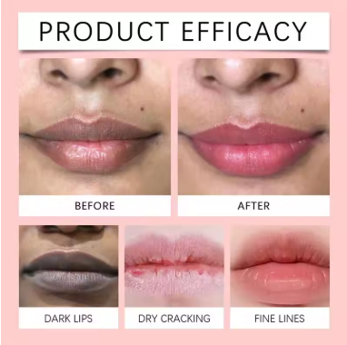 Fast Lighten Melanin Lip Mask Remove Dark Lip Balm Serum Exfoliating Fade Lip Lines Dead Skin Nourishing Repair Lip Care Makeup