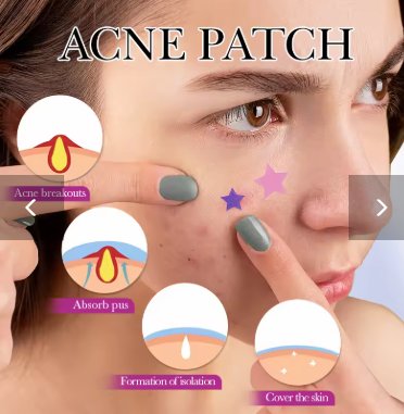 7/10/14Pcs Colorful Star Acne Patch Improve Women Skin Hydrocolloid Acne Tool Invisible Acne Cover Pimple Patch Skin Care Tools
